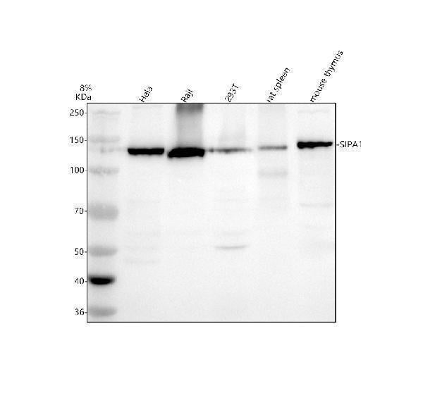 Anti-SIPA1 Antibody Picoband® Boster Bio