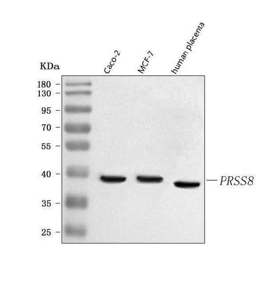 Anti-PRSS8 Antibody Picoband® Boster Bio