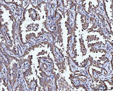 Anti-CCL15 Antibody Boster Bio