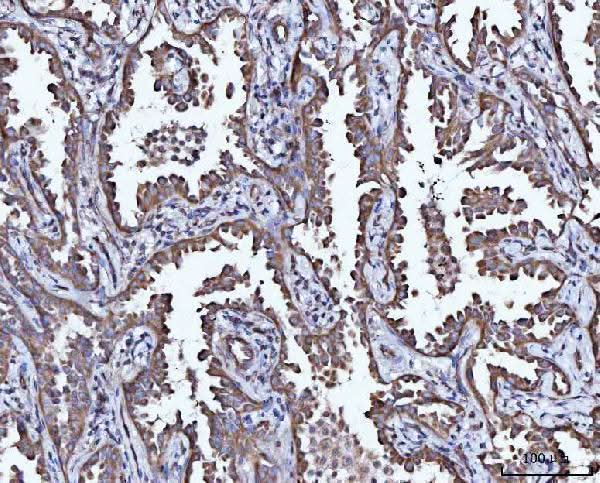 Anti-CCL15 Antibody Boster Bio