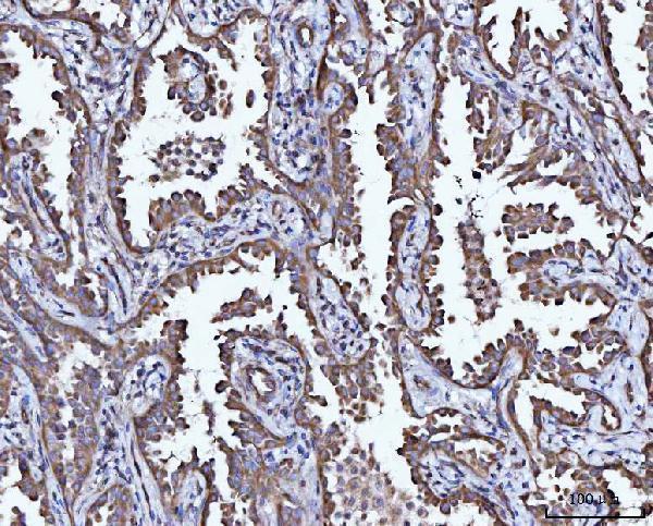 Anti-CCL15 Antibody Boster Bio
