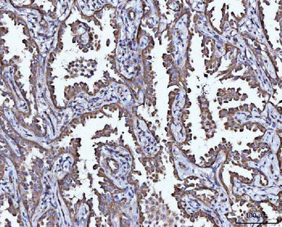 Anti-CCL15 Antibody Boster Bio