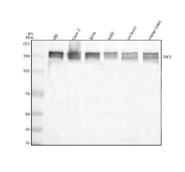 Anti-SIK3 Antibody Picoband® Boster Bio