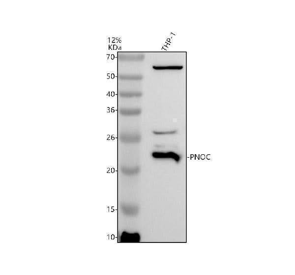 Anti-PNOC Antibody Picoband® Boster Bio