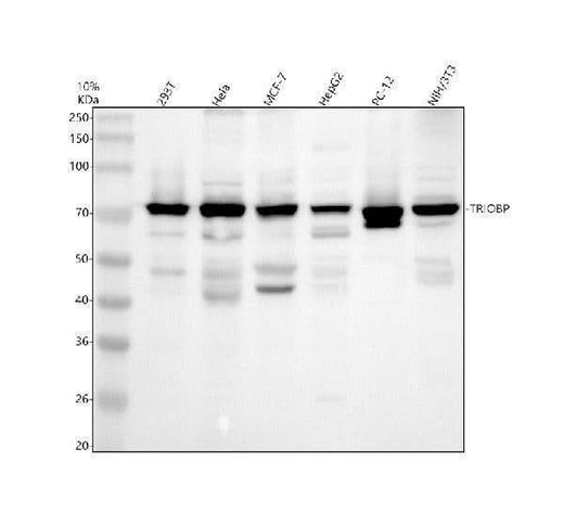 Anti-TRIOBP Antibody Picoband® Boster Bio