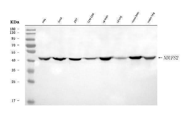 Anti-NDUFS2 Antibody Picoband® Boster Bio
