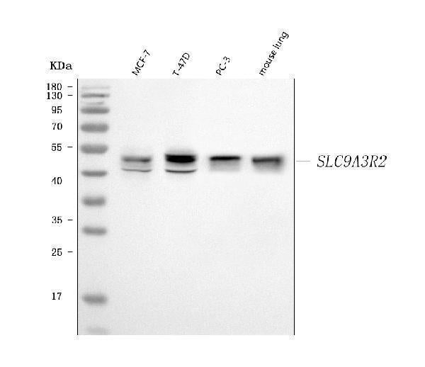 Anti-NHERF-2/SIP-1/SLC9A3R2 Antibody Picoband® Boster Bio
