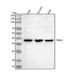Anti-TFB2M Antibody Picoband® Boster Bio