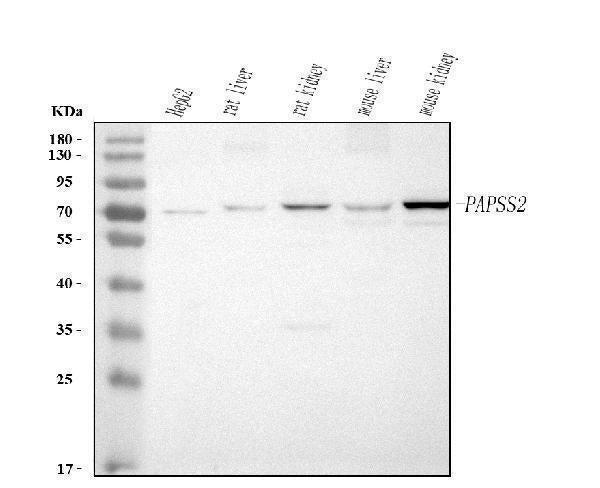 Anti-PAPSS2 Antibody Picoband® Boster Bio