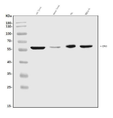 Anti-CPN1 Antibody Picoband® Boster Bio