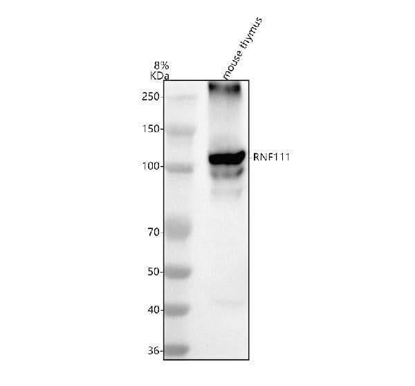 Anti-RNF111 Antibody Picoband® Boster Bio