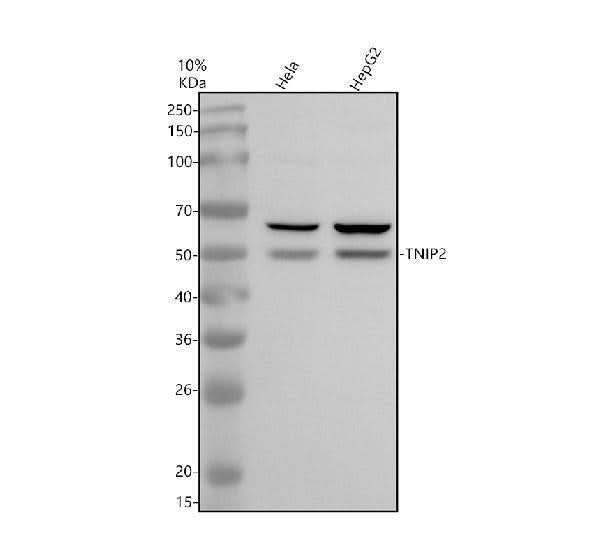 Anti-TNIP2 Antibody Picoband® Boster Bio