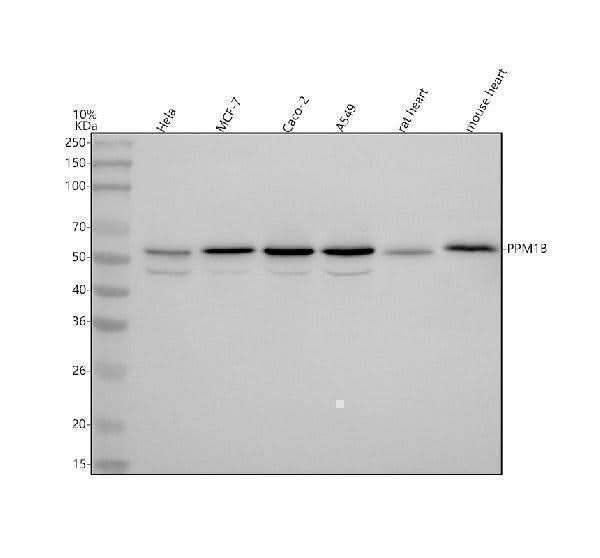 Anti-PPM1B Antibody Picoband® Boster Bio