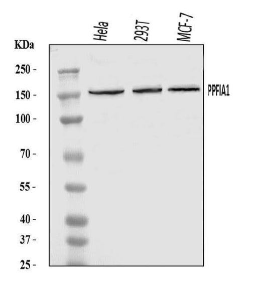 Anti-PPFIA1 Antibody Picoband® Boster Bio