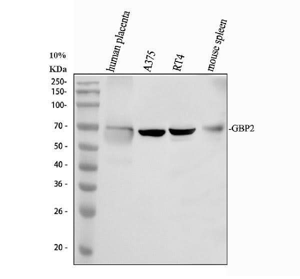 Anti-GBP2 Antibody Picoband® Boster Bio