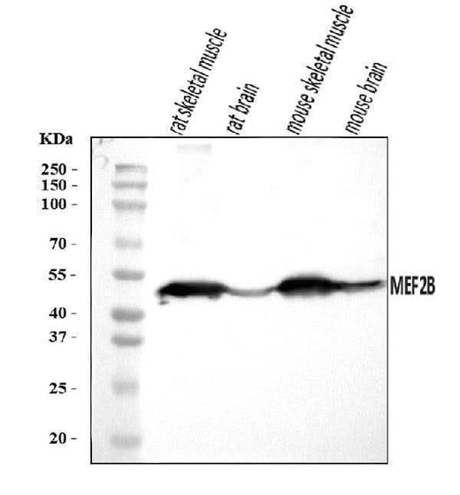 Anti-MEF2B Antibody Picoband® Boster Bio