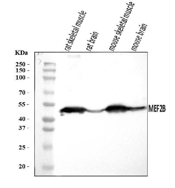 Anti-MEF2B Antibody Picoband® Boster Bio