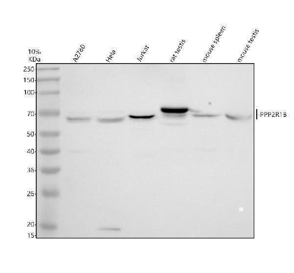 Anti-PPP2R1B Antibody Picoband® Boster Bio