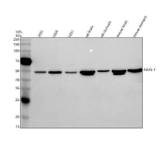 Anti-NKX6-1 Antibody Picoband® Boster Bio
