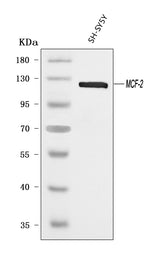 Anti-DBL Antibody Picoband® Boster Bio