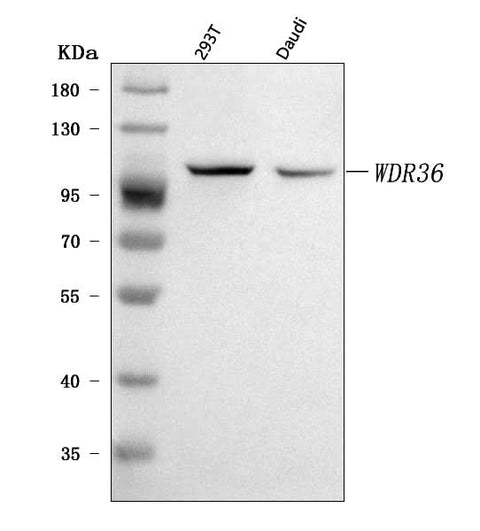 Anti-WDR36 Antibody Picoband® Boster Bio