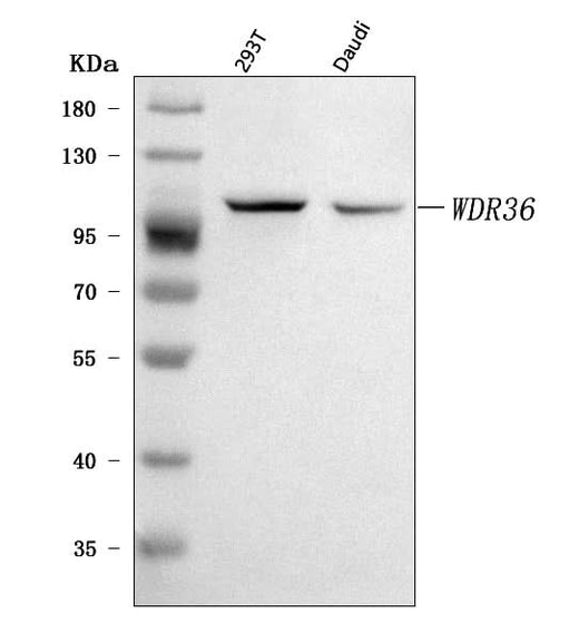 Anti-WDR36 Antibody Picoband® Boster Bio