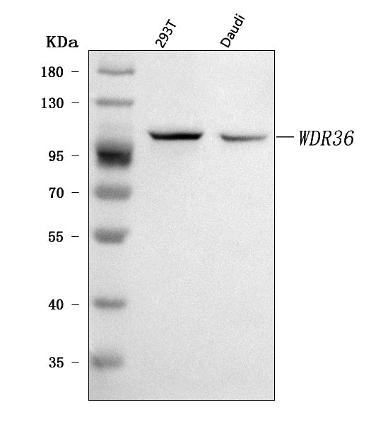 Anti-WDR36 Antibody Picoband® Boster Bio