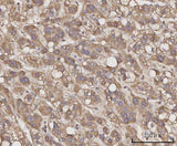 Anti-CCL23 Antibody Boster Bio
