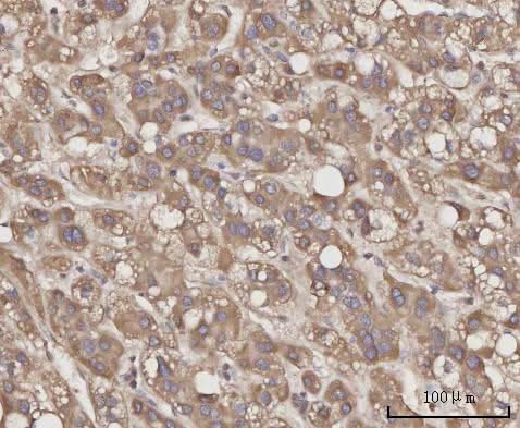 Anti-CCL23 Antibody Boster Bio