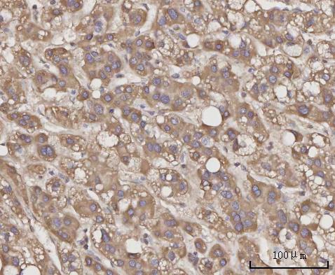 Anti-CCL23 Antibody Boster Bio