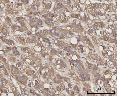 Anti-CCL23 Antibody Boster Bio