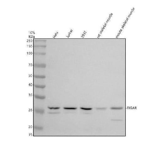 Anti-TIGAR Antibody Picoband® Boster Bio