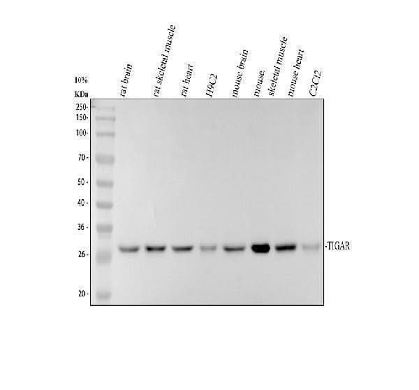 Anti-TIGAR Antibody Picoband® Boster Bio