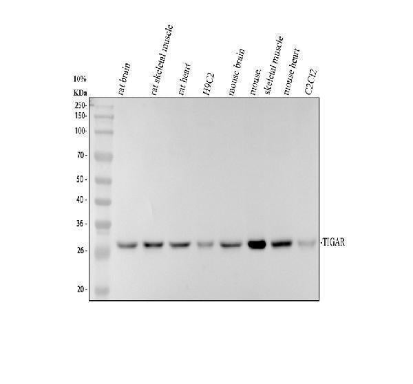 Anti-TIGAR Antibody Picoband® Boster Bio
