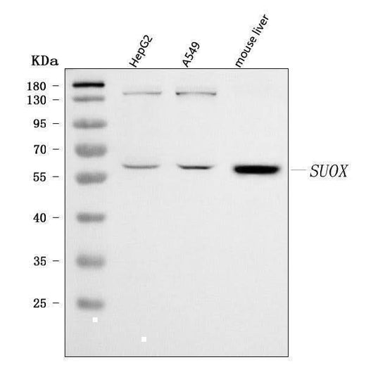 Anti-Sulfite oxidase/SUOX Antibody Picoband® Boster Bio