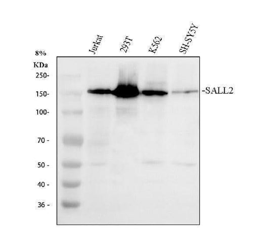 Anti-SALL2 Antibody Picoband® Boster Bio