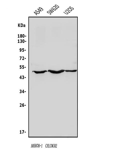 Anti-NDP52/CALCOCO2 Antibody Picoband® Boster Bio