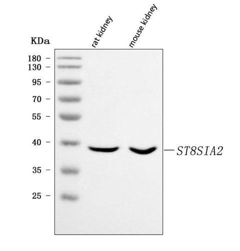 Anti-ST8SIA2 Antibody Picoband® Boster Bio