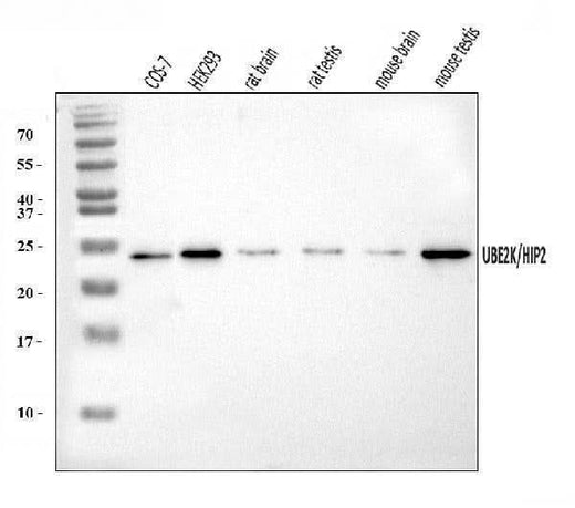 Anti-HIP2/LIG/UBE2K Antibody Picoband® Boster Bio