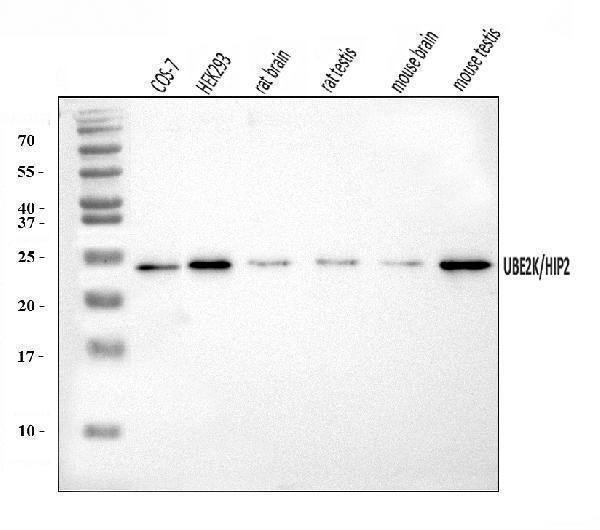 Anti-HIP2/LIG/UBE2K Antibody Picoband® Boster Bio