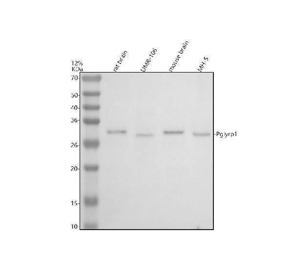 Anti-PGLYRP1 Antibody Picoband® Boster Bio