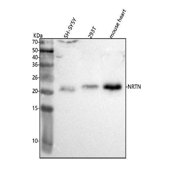 Anti-NRTN Antibody Picoband® Boster Bio