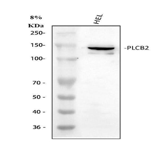 Anti-PLCB2 Antibody Picoband® Boster Bio