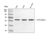 Anti-PPP2R5A Antibody Picoband® Boster Bio