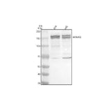 Anti-MTMR3 Antibody Picoband® Boster Bio