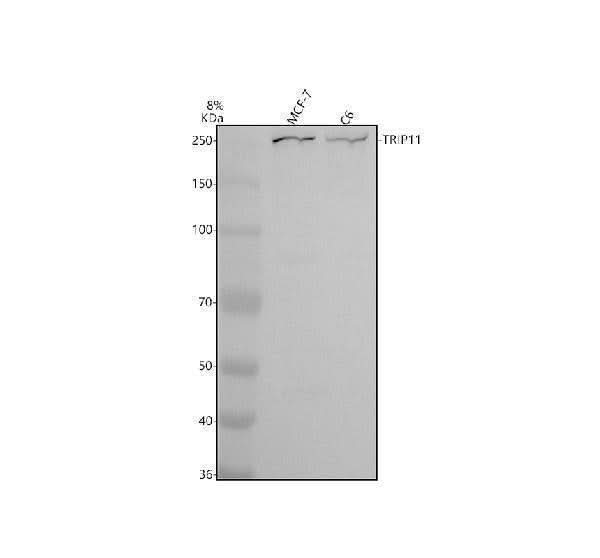 Anti-GMAP-210/TRIP11 Antibody Picoband® Boster Bio