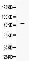 Anti-ACSL3 Antibody Picoband® Boster Bio