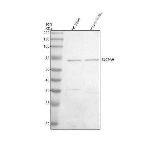 Anti-SLC9A9 Antibody Picoband® Boster Bio