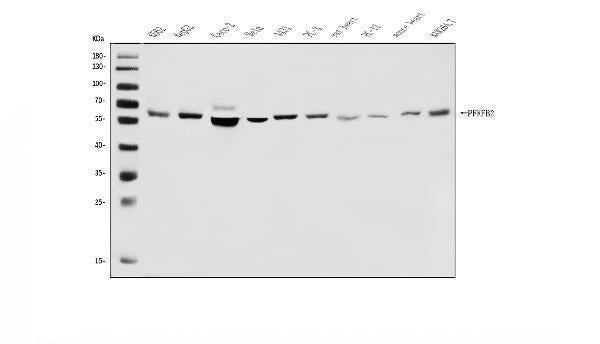 Anti-PFKFB2 Antibody Picoband® Boster Bio