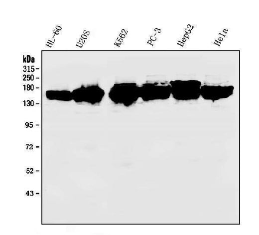 Anti-KIF15 Antibody Picoband® Boster Bio